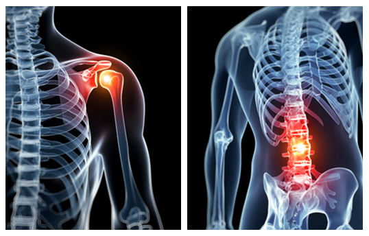 How To Fix Pain In Your Back & Shoulders - Enhance Integrated Wellness